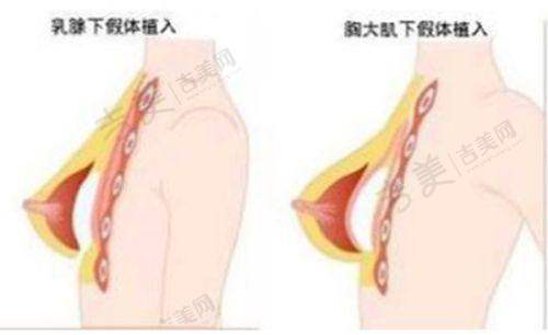 王涛医生正颌技术有何独特之处？