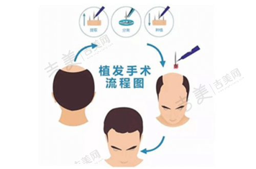 深圳和美哈弗医学美容中 心怎么样,口碑评价如何?