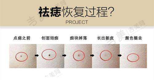 六、面部清奥实例，成效看得见？