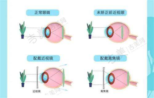 平顶山市斜视矫正术哪家好？市第一人民医院骨干医生团队优势总结