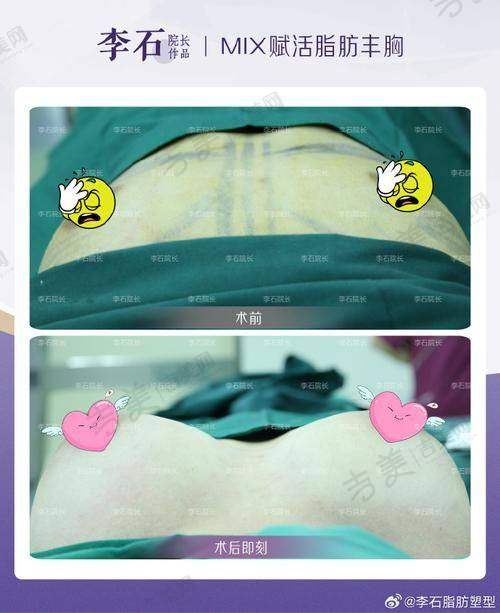 深圳流花医院美容门诊部项目特色