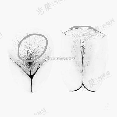 深圳韩星医疗美容医院怎么样，口碑评价如何？