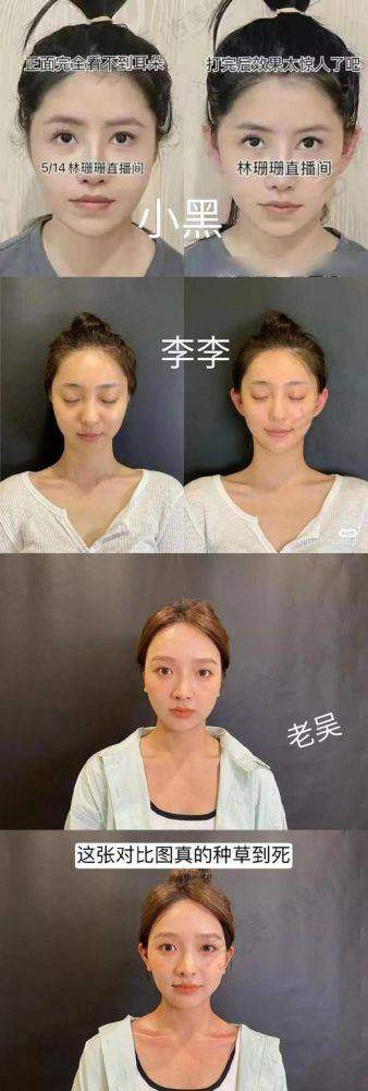 深圳流花医院美容门诊部地址及乘车路线
