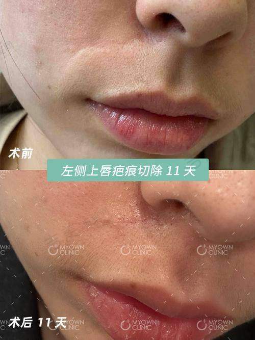 深圳和美哈弗医学美容中 心医生简介