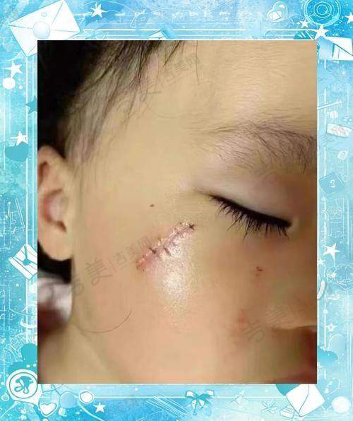 深圳流花医院美容门诊部怎么样，口碑评价如何？
