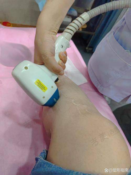 深圳晨曦医疗美容医院口碑好不好？附真实患者口碑评价