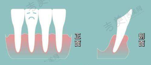 西安美合医疗美容（未央店）林合晟医生的专精领域是什么？