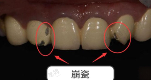 温州瑞安顶新口腔门诊部价格表