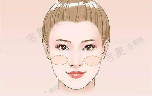 吕方中医生修复双眼皮口碑好，医院提供了哪些支持？
