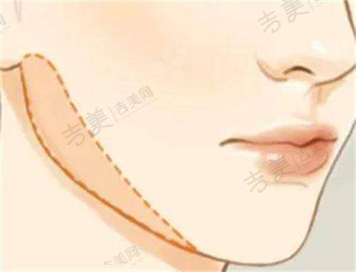 湘潭中 心医院整形科新版价目表之其他项目