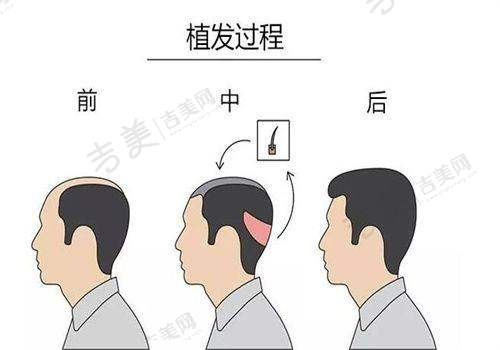 青海红十字医院整形美容口碑评价情况