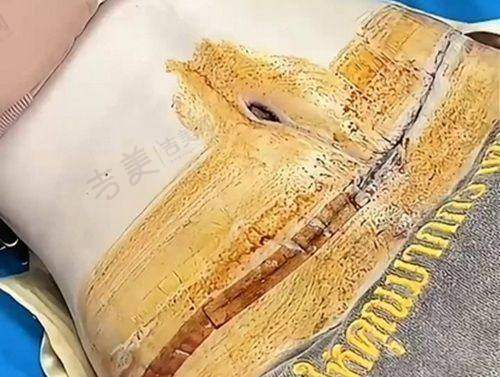 王毅超医生收获的顾客好评