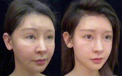 王毅超医生的口碑评价及真实反馈内容