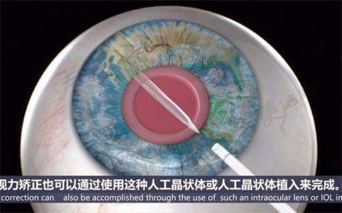河北二院眼科电话24小时人工服务热线特需门诊和普通门诊有什么区别？