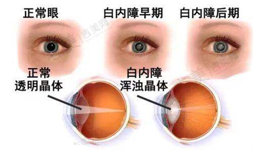 宜春爱尔眼科医院正规性与便利性介绍