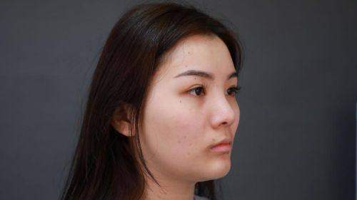 李伟光医生擅长的包头医疗美容项目