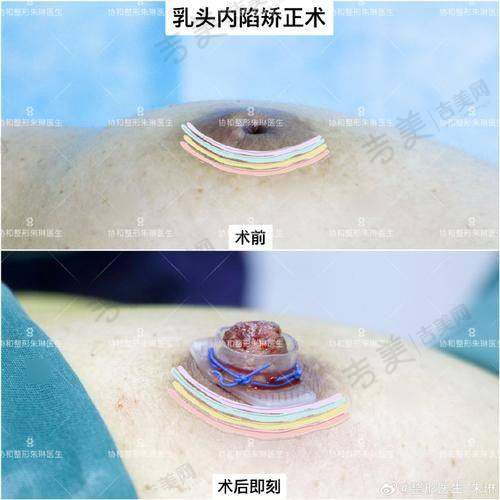 白虎包头华美医疗美容医院医生擅长项目