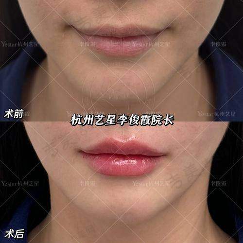 青海红十字医院整形美容医生团队介绍