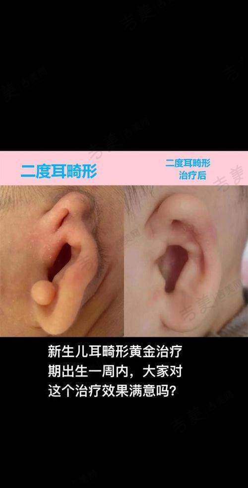 王众医生 - 包头华美擅长项目介绍