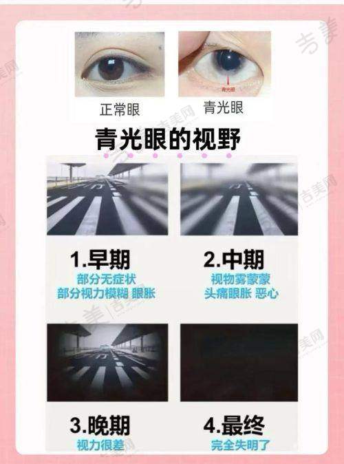 本溪爱尔眼科医院白内障技术与预约方式