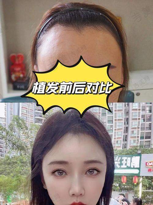 青海红十字医院整形美容地址及乘车路线指南