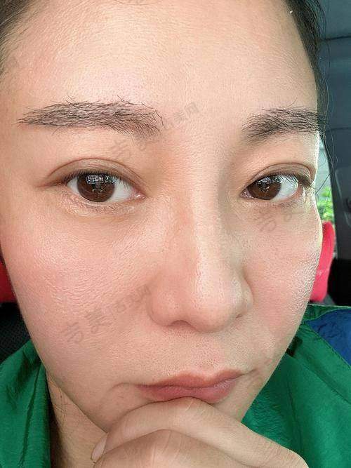 青海米澜之星整形美容医院怎么样，口碑评价如何