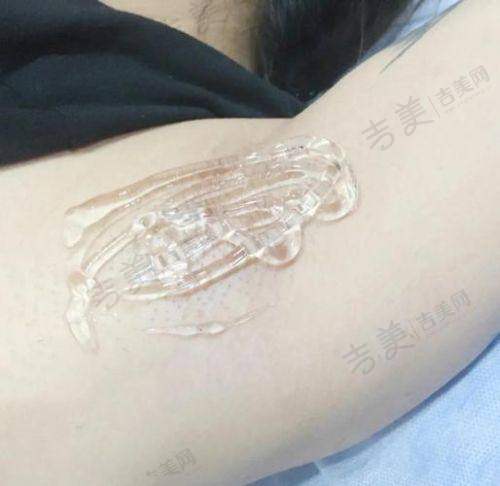 江门玛丽整形美容诊所可靠吗