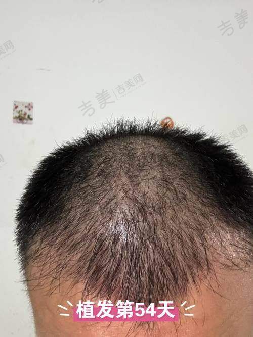 青海省人民医院整形科口碑好不好？附真实患者口碑评价