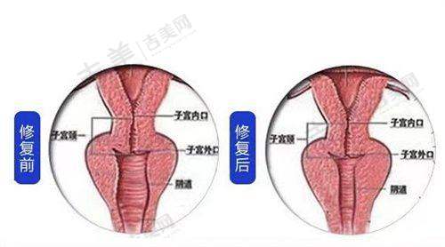 杭州阿波罗医院是私立的吗？现代化设施与环境