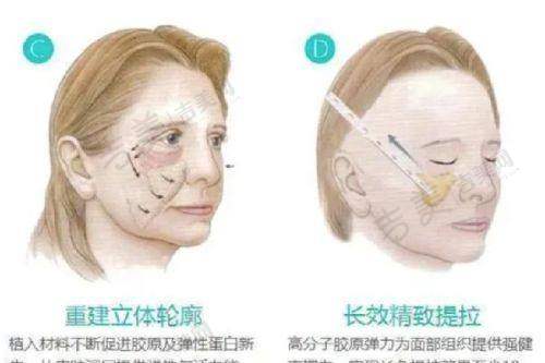 西宁正规整形医院排名有哪家之青海大学附属医院
