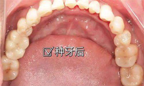 赵玲珑医生个人资料及临床经验介绍