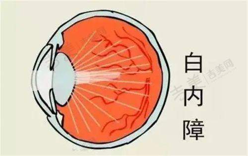 赣州爱尔眼科医院服务与环境