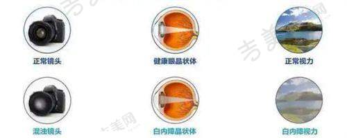 大庆爱尔眼科医院与其他医院相比有什么优势