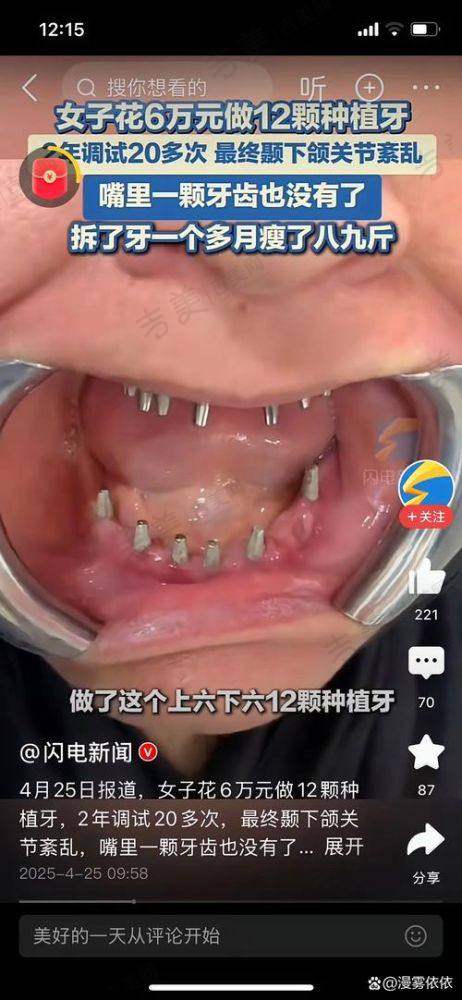 李力医生擅长的口腔项目