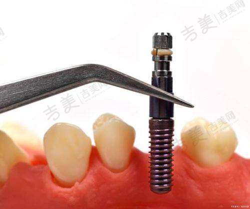 李君首医生的个人资料简介