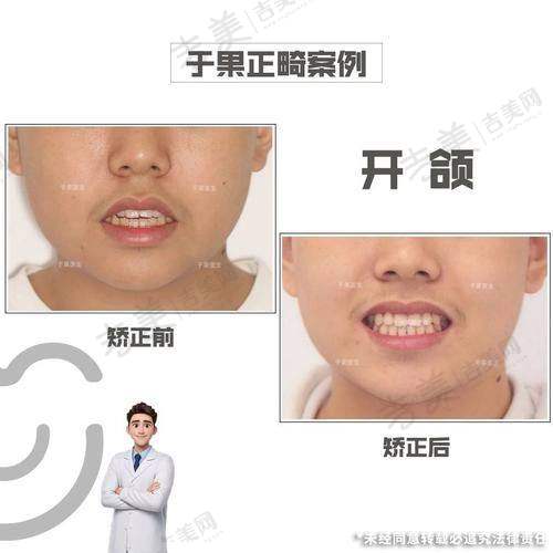 吴丹丹医生的口碑评价及反馈内容