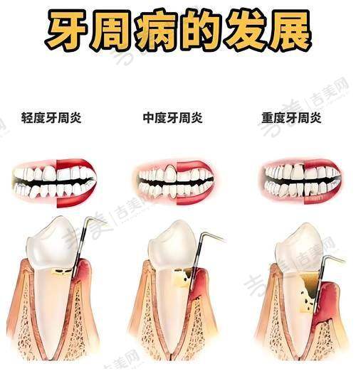 李君首医生擅长的种植项目
