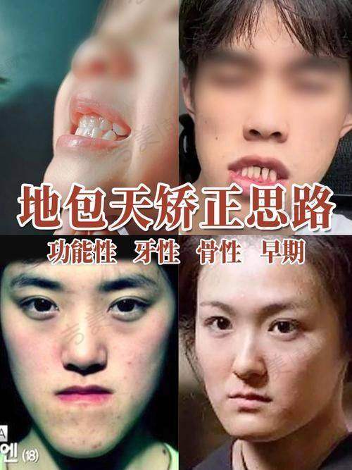 侯晓辉医生擅长的牙齿矫正项目