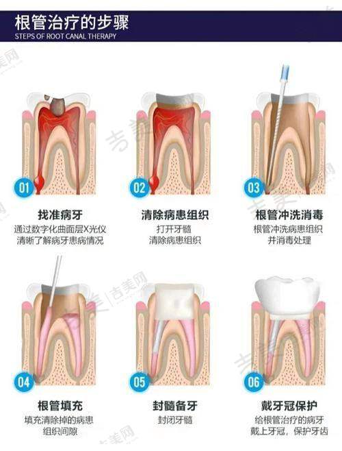 六安雅悦口腔医院项目特色