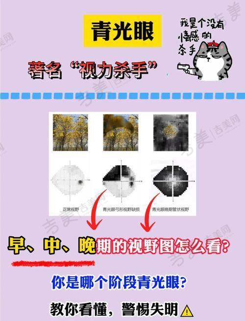 甘肃爱尔眼科医院青光眼治疗价格与方案多样