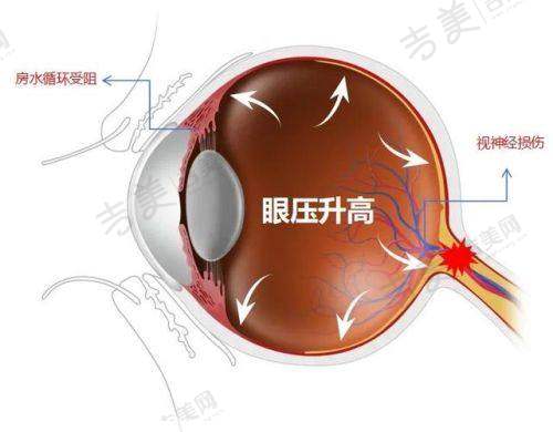 恩施爱尔眼科医院公益理念：公益先行关爱眼健康