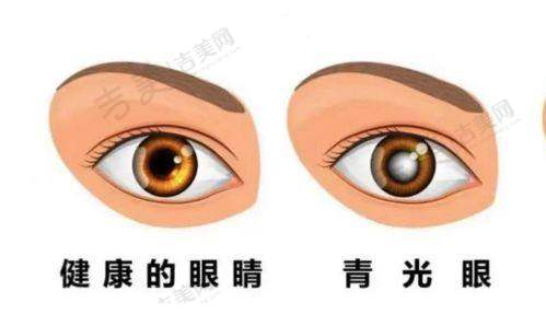 承德爱尔眼科医院的地址和上班时间是怎样的