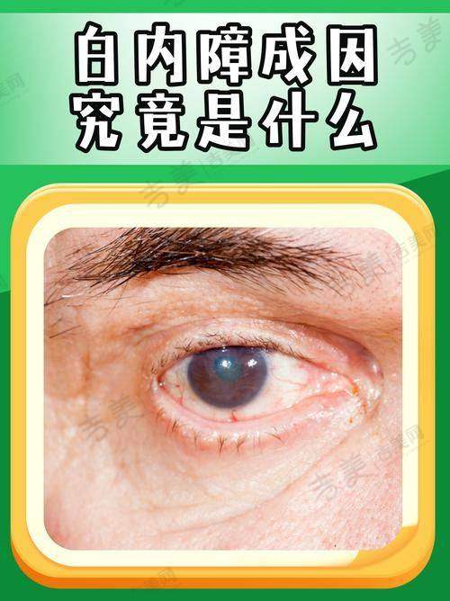 广州黄埔爱尔眼科医院医院概况介绍