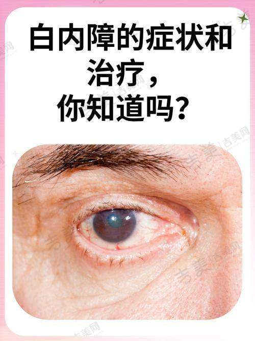 大理爱尔眼科医院多样挂号方式