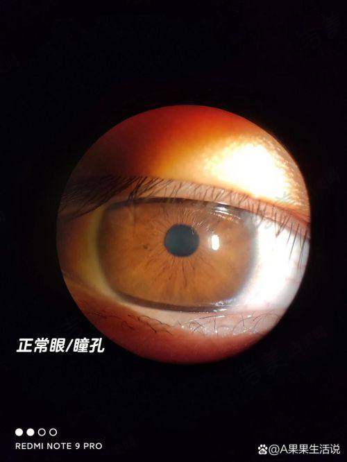 赣州爱尔眼科医院患者口碑与评价反馈
