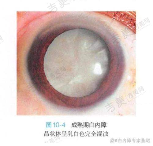 广州花都爱尔眼科医院服务质量怎样