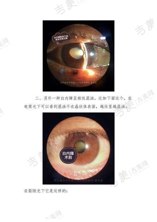 福州爱尔眼科医院丰富特色项目