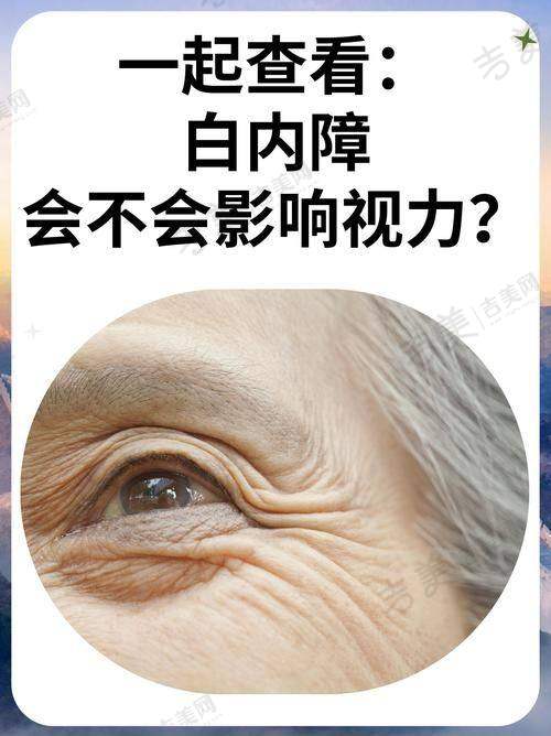 广州爱尔眼科医院眼底病治疗医生及显著成果