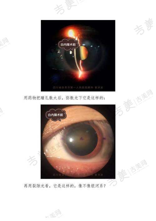赣州爱尔眼科医院的发展前景展望
