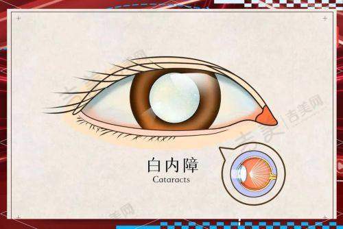 恩施爱尔眼科医院特色服务:为视力健康保驾护航